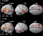 Aging patterns of Japanese auditory semantic processing: an fMRI study