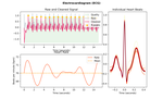 NeuroKit2: A Python toolbox for neurophysiological signal processing