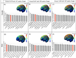 Sex difference in tDCS current mediated by changes in cortical anatomy: A study across young, middle and older adults