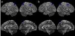 Working memory, age and education: A lifespan fMRI study