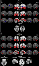 Functional connectivity of resting-state, working memory and inhibition networks in perceived stress