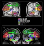 Cerebro-cerebellar pathways for verbal working memory