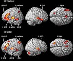 Aging patterns of Japanese auditory semantic processing: an fMRI study