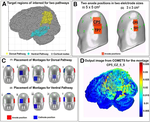 Simulation analyses of tDcS montages for the investigation of dorsal and ventral pathways