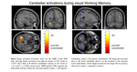 Cerebellar Transcranial Magnetic Stimulation (TMS) Impairs Visual Working Memory