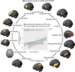 Longitudinal evaluation of common and unique brain-networks in variants of primary progressive aphasia