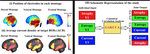 The role of structural and functional parameters in designing pathology-specific tDCS protocols for primary progressive aphasia