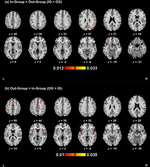 A Meta-Analysis of Functional Magnetic Resonance Imaging Studies on In-Group and Out-Group Categorization